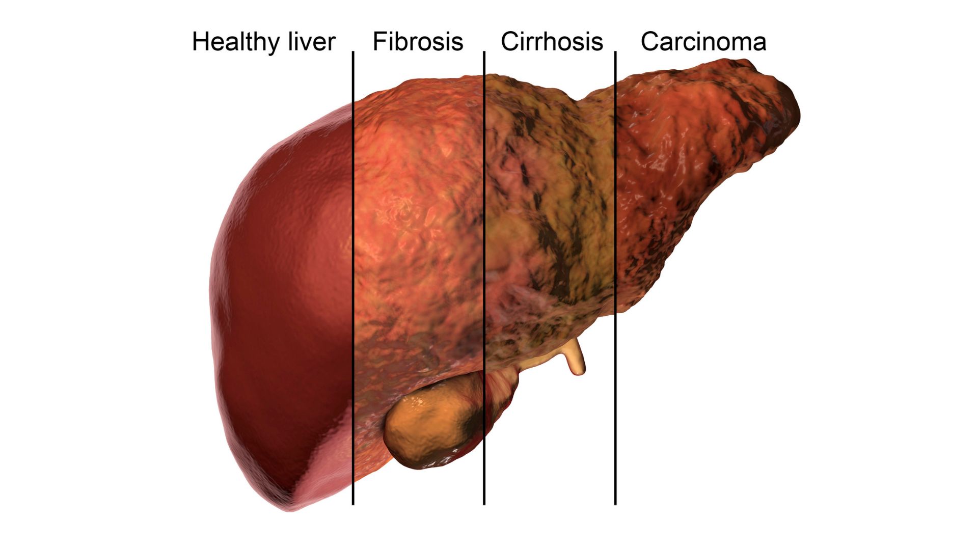 Clinical Study Image